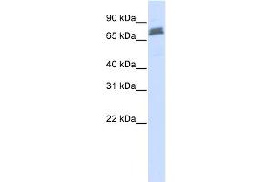 WB Suggested Anti-TRIM45 Antibody Titration:  0. (TRIM45 抗体  (N-Term))