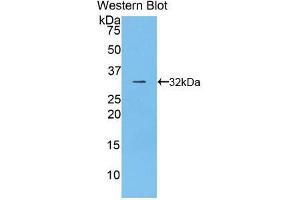 Western blot analysis of the recombinant protein. (CD2AP 抗体  (AA 368-623))