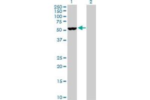 Western Blot analysis of NOVA1 expression in transfected 293T cell line by NOVA1 MaxPab polyclonal antibody. (NOVA1 抗体  (AA 1-507))