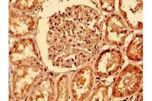 IHC image of ABIN7173825 diluted at 1:400 and staining in paraffin-embedded human kidney tissue performed on a Leica BondTM system.