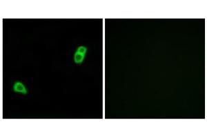 Immunofluorescence analysis of LOVO cells, using GPR34 antibody.