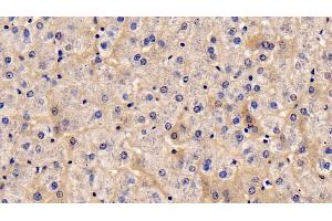 Detection of TSLP in Human Liver Tissue using Monoclonal Antibody to Thymic Stromal Lymphopoietin (TSLP) (Thymic Stromal Lymphopoietin 抗体  (AA 29-159))