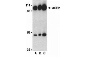 Western Blotting (WB) image for anti-Angiotensin I Converting Enzyme 2 (ACE2) (C-Term) antibody (ABIN1030215) (ACE2 抗体  (C-Term))