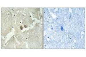 Immunohistochemistry analysis of paraffin-embedded human brain tissue using NSG2 antibody. (NSG2 抗体)