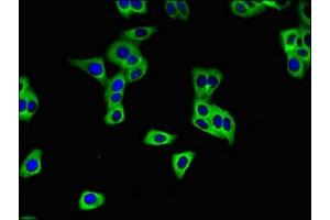 Immunofluorescence (IF) image for anti-Solute Carrier Family 28 (Sodium-Coupled Nucleoside Transporter), Member 3 (SLC28A3) (AA 1-102) antibody (ABIN7170219)