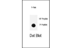 Dot blot analysis of anti-Phospho-TrkA- Pab (ABIN389679 and ABIN2839650) on nitrocellulose membrane.