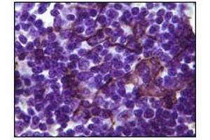 Immunohistochemistry (IHC) image for anti-B Lymphoid Tyrosine Kinase (BLK) (truncated) antibody (ABIN2464016) (BLK 抗体  (truncated))