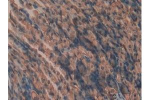 Immunohistochemistry (IHC) image for anti-Cyclophilin B (PPIB) (AA 34-216) antibody (ABIN7431392)
