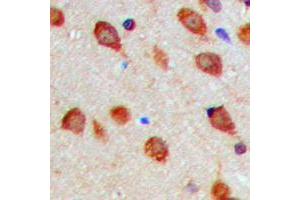 Immunohistochemistry (IHC) image for anti-Aurora Kinase A (AURKA) (pSer288) antibody (ABIN7301500)