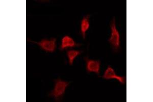 ABIN6276078 staining MCF7 by IF/ICC. (OR2T11 抗体  (Internal Region))