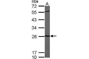 WB Image Sample (50 ug of whole cell lysate) A: Mouse brain 12% SDS PAGE antibody diluted at 1:1000 (PSMA6 抗体  (Center))