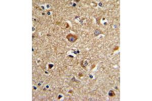 Formalin-fixed and paraffin-embedded human brain tissue with CD81 Antibody (C-term), which was peroxidase-conjugated to the secondary antibody, followed by DAB staining. (CD81 抗体  (C-Term))
