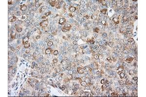 Immunohistochemical staining of paraffin-embedded Human liver tissue using anti-BCL10 mouse monoclonal antibody. (BCL10 抗体)