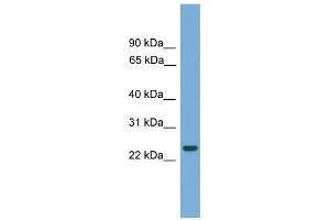 C19orf18 antibody used at 1 ug/ml to detect target protein. (C19orf18 抗体  (N-Term))