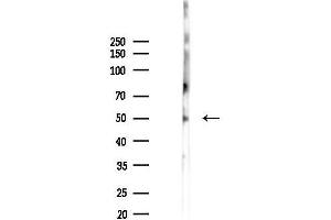 Western blot analysis of lysates from K562 cells(starvation 24h treatment), using Cytochrome P450 2 Antibody at 1/1000 dilution.