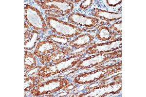 Immunohistochemistry (IHC) image for anti-NADH Dehydrogenase (Ubiquinone) 1 beta Subcomplex, 8, 19kDa (NDUFB8) antibody (ABIN7268813)