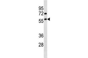 TRIM13 antibody western blot analysis in HepG2 lysate. (TRIM13 抗体  (AA 61-90))