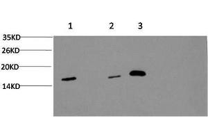 Western Blot analysis of 1) Hela, 2) 3T3, 3) Rat brain using MAP1LC3A Monoclonal Antibody at dilution of 1:1000. (MAP1LC3A 抗体)