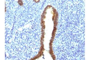 Immunohistochemistry (IHC) image for anti-Asparaginase Like 1 (ASRGL1) antibody (ABIN6940944)