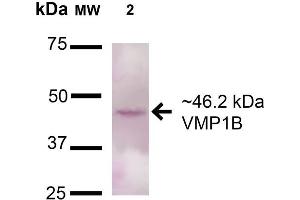 Western blot analysis of Rat Pancreas cell lysates showing detection of 46. (VMP1 抗体  (AA 391-402) (Biotin))