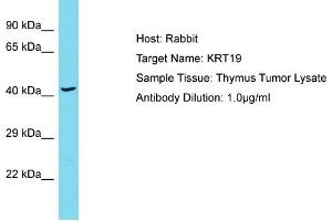 Host: Rabbit Target Name: KRT19 Sample Type: Thymus Tumor lysates Antibody Dilution: 1. (Cytokeratin 19 抗体  (Middle Region))