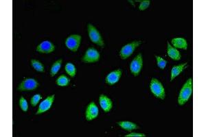 Immunofluorescent analysis of A549 cells using ABIN7159245 at dilution of 1:100 and Alexa Fluor 488-congugated AffiniPure Goat Anti-Rabbit IgG(H+L) (MLANA 抗体  (AA 48-118))