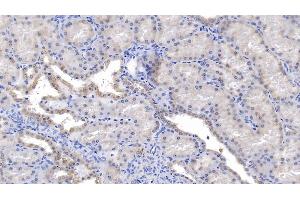 Detection of PRDX5 in Human Kidney Tissue using Polyclonal Antibody to Peroxiredoxin 5 (PRDX5) (Peroxiredoxin 5 抗体  (AA 1-162))