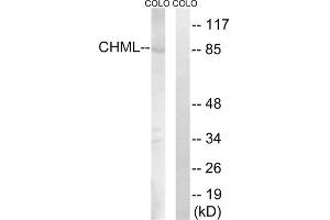 Western blot analysis of extracts from COLO cells, using CHML antibody. (CHML 抗体  (Internal Region))