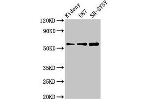 Western Blot Positive WB detected in: Mouse kidney tissue, U87 whole cell lysate, SH-SY5Y whole cell lysate All lanes: KCNAB1 antibody at 3. (KCNAB1 抗体  (AA 287-401))