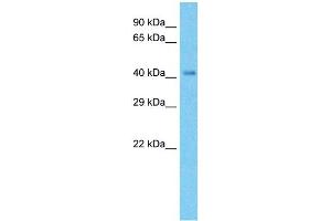 Host:  Rabbit  Target Name:  NDUFV1  Sample Type:  Fetal liver Cell lysates  Antibody Dilution:  1.