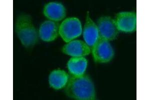 anti-Eukaryotic Translation Initiation Factor 5A (EIF5A) (AA 86-154) antibody