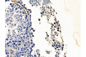 PHF8 Antibody at 1/100 staining Mouse testis tissue by IHC-P. (PHF8 抗体  (C-Term))