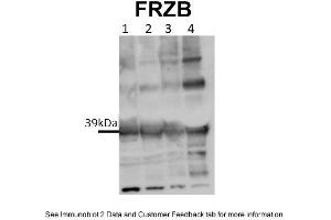 WB Suggested Anti-FRZB Antibody Titration: 0. (FRZB 抗体  (Middle Region))