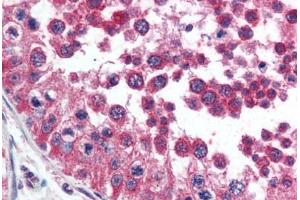 Human Testis (formalin-fixed, paraffin-embedded) stained with HAVCR1 antibody ABIN292372 at 2. (HAVCR1 抗体  (AA 200-300))