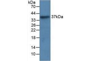Detection of Recombinant LRG1, Human using Monoclonal Antibody to Leucine Rich Alpha-2-Glycoprotein 1 (LRG1) (LRG1 抗体  (AA 37-340))
