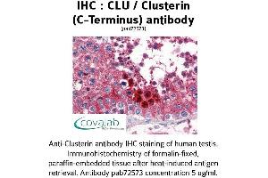 Image no. 1 for anti-Clusterin (CLU) (C-Term) antibody (ABIN1733163) (Clusterin 抗体  (C-Term))