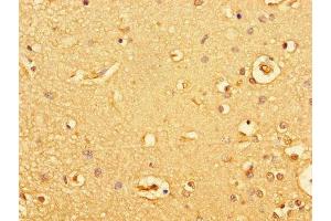 Immunohistochemistry of paraffin-embedded human brain tissue using ABIN7154928 at dilution of 1:100 (GUCY2C 抗体  (AA 636-891))