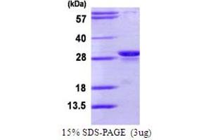 SDS-PAGE (SDS) image for Proteasome (Prosome, Macropain) Subunit, beta Type 10 (PSMB10) (AA 40-273) protein (His tag) (ABIN7279563) (PSMB10 Protein (AA 40-273) (His tag))