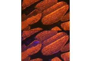 Immunofluorescence analysis of mouse skeletal muscle using α-Actin-1  Rabbit mAb (ABIN3015986, ABIN3015987, ABIN1680683 and ABIN1680684) at dilution of 1:100 (40x lens). (Actin 抗体)