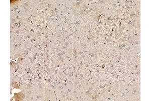 ABIN6265035 and ABIN6279859 at 1/100 staining rat brain tissue by IHC-P. (SFRS9 抗体  (Internal Region))