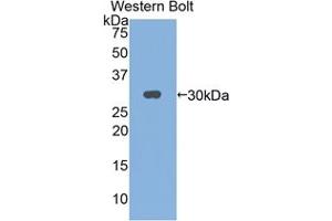Western blot analysis of the recombinant protein. (IL2RG 抗体  (AA 23-263))