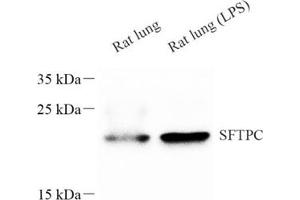 Western blot analysis of sftpc (ABIN7075216),at dilution of 1: 600 (Prosurfactant Protein C 抗体)