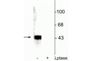 Western blot of human T47D cell lysate showing specific immunolabeling of ~42-44 kDa ERK/MAPK protein phosphorylated at Thr202/Tyr204 in the first lane (-). (MAPK1/2 (pThr202), (pTyr204) 抗体)
