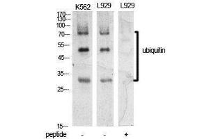 Western Blotting (WB) image for anti-Ubiquitin (Ubiquitin) (Internal Region) antibody (ABIN3181396) (Ubiquitin 抗体  (Internal Region))