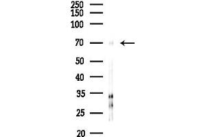 anti-Propionyl CoA Carboxylase, alpha Polypeptide (PCCA) (C-Term) antibody