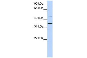 WB Suggested Anti-CLN6 Antibody Titration:  0. (CLN6 抗体  (C-Term))