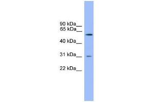 Western Blot showing PCSK2 antibody used at a concentration of 1-2 ug/ml to detect its target protein. (PCSK2 抗体  (Middle Region))
