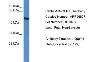 WB Suggested Anti-CERKL  Antibody Titration: 0. (CERKL 抗体  (C-Term))