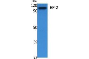 Western Blot (WB) analysis of specific cells using EF-2 Polyclonal Antibody. (EEF2 抗体  (Ser311))