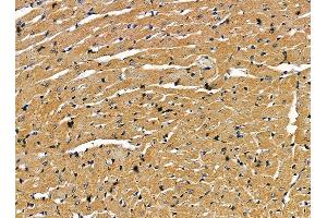 ABIN7095381 and ABIN7099438 at 1/100 staining rat heart tissue by IHC-P. (Endogenous retrovirus group 3 member 1 Env polyprotein (ERV3-1) 抗体)